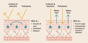 Skin Barrier