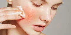 skin barrier repair