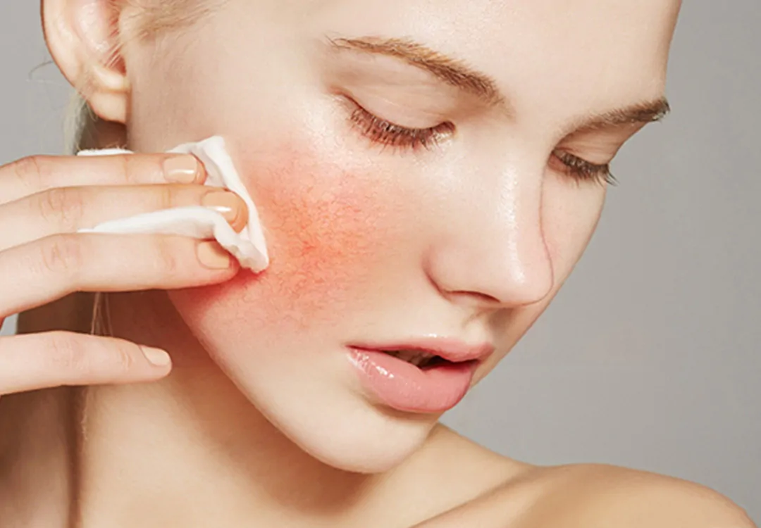 skin barrier repair