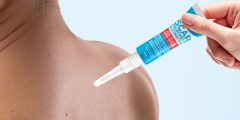 Best Scar Treatment Products