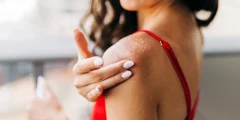 Heal Sunburn Fast with proven skin repair tips