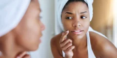 remove dark spots naturally