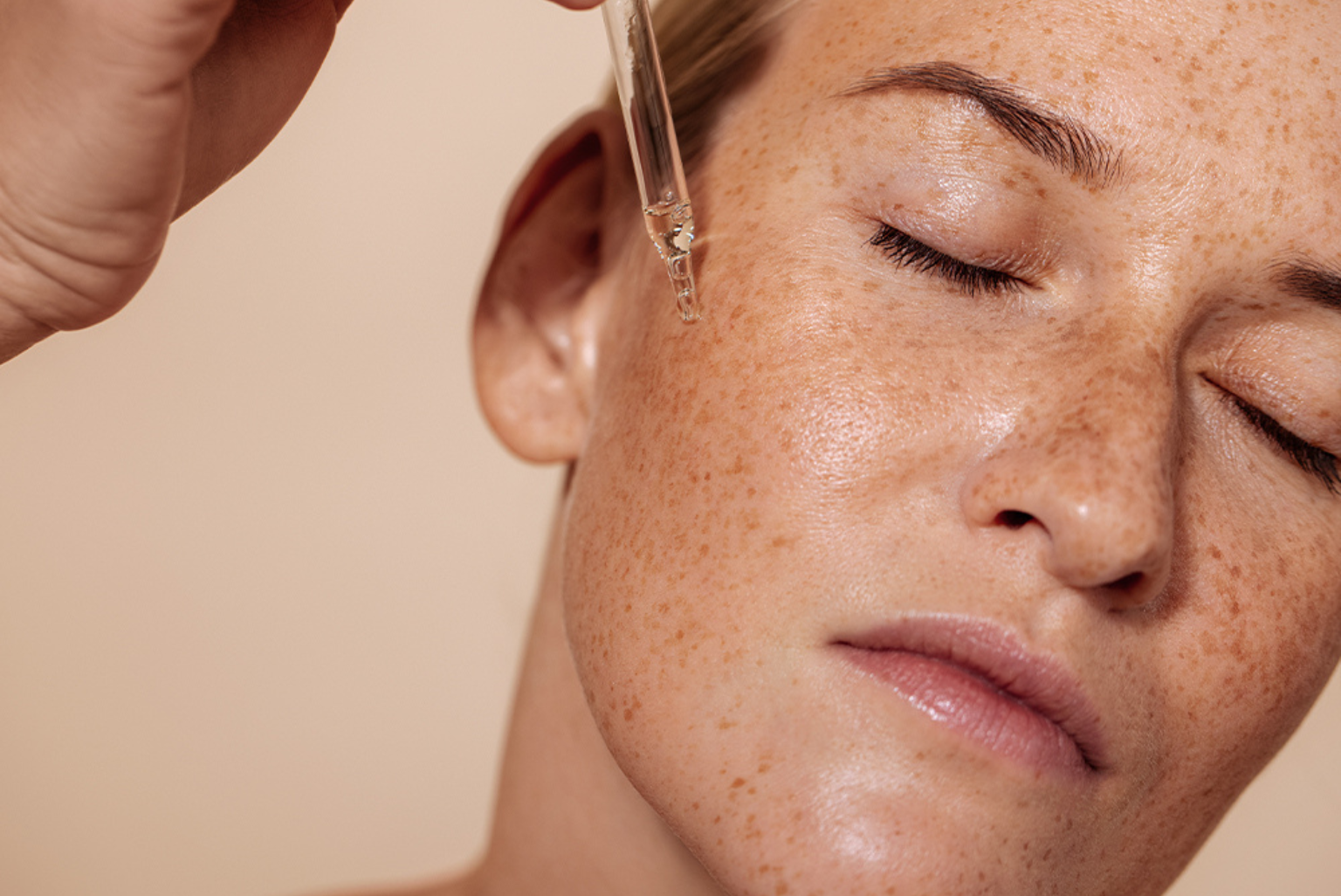 Treating Hyperpigmentation